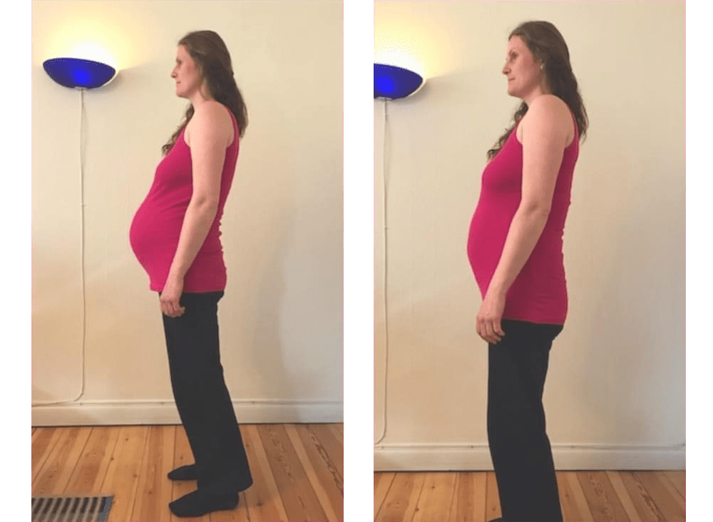 KST Gravid før og efter behandling
